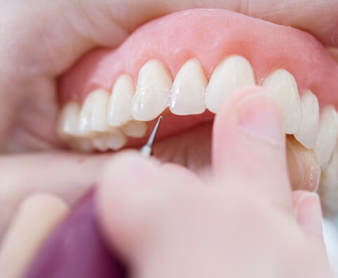closeup of a set of dentures