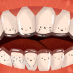 Cartoon image of smiling teeth with Invisalign clear aligners