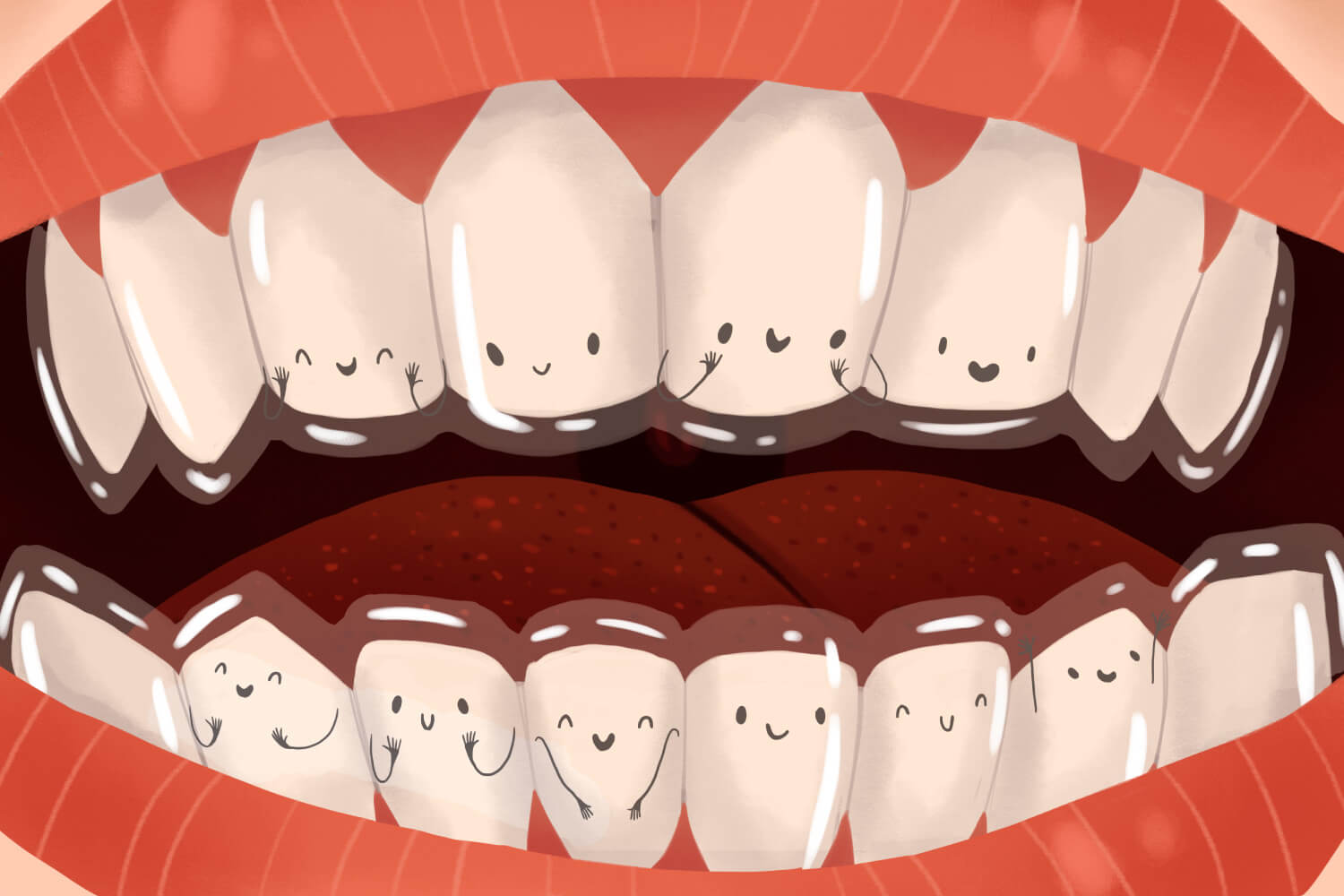 Cartoon image of smiling teeth with Invisalign clear aligners